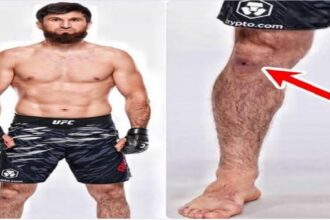 Dramatic Staph Infection Rumors Swirl Around Magomed Ankalaev Ahead of Epic UFC 308 Showdown 1